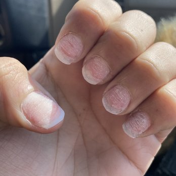 Sunny Nail Salon - Crappy job or removing the tips. I'm still waiting in my nails to recover so I can go get a new set - Nail Salons Near Me - Palmer, Massachusetts Sunny Nail Salon - Crappy job or removing the tips. I'm still waiting in my nails to recover so I can go get a new set - Nail Salons Near Me - Palmer, Massachusetts