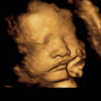 Blossom Baby - Diagnostic Imaging Near Me - Oceanside, California Blossom Baby - Diagnostic Imaging Near Me - Oceanside, California