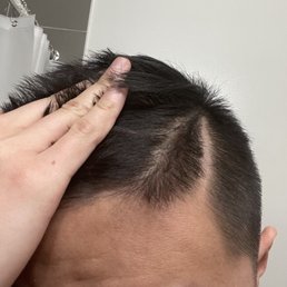 Showing where my natural part is vs. where Nick put my part. Showing where my natural part is vs. where Nick put my part.
