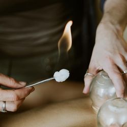 Rooting Wellness Acupuncture