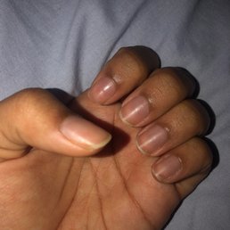 all of my nails are off in this hand
