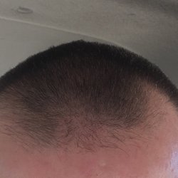 Great Clips - This is after I asked 3 times If she was sure that it was all even on top.. how hard is it to look down and see al the uneven shave lines??