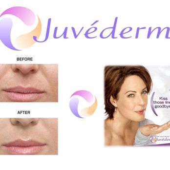 Brian M. Brown MD - JUVÉDERM® is the #1 selling collection of hyaluronic acid fillers in the USA. Each product in the JUVÉDERM® collection adds volume to differ - Ophthalmologists Near Me - Downey, California