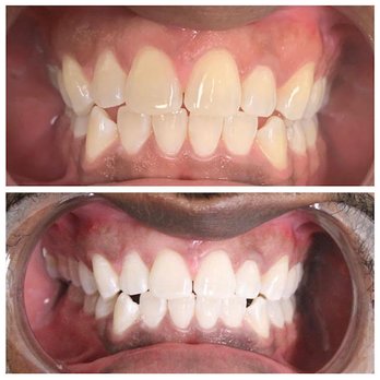 Build A Smile - Cosmetic Dentists Near Me - Charlotte, North Carolina Build A Smile - Cosmetic Dentists Near Me - Charlotte, North Carolina