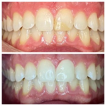 Phuong K Tran, DDS - New Leaf Dentistry - General Dentistry Near Me - Encinitas, California Phuong K Tran, DDS - New Leaf Dentistry - General Dentistry Near Me - Encinitas, California