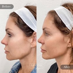 LaVida Medspa