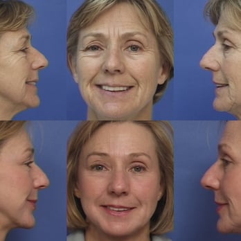 George E. Peck, MD - Cosmetic Surgeons Near Me - West Orange, New Jersey George E. Peck, MD - Cosmetic Surgeons Near Me - West Orange, New Jersey