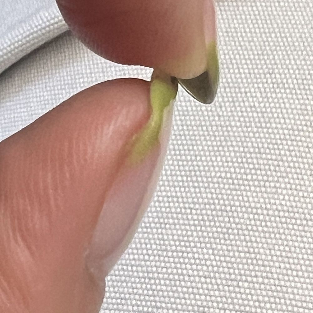 Patsy Nails Spa - Natural nail is now weak and bends due to nail tech filing down too much - Nail Salons Near Me - Inglewood, California Patsy Nails Spa - Natural nail is now weak and bends due to nail tech filing down too much - Nail Salons Near Me - Inglewood, California