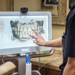 Lifetime Cosmetic Dentistry - Modern technology 3-D scanner