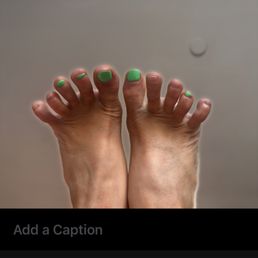 1 week post gel pedicure. 1 week post gel pedicure.