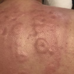Yeh's Art of Healing - Detoxing