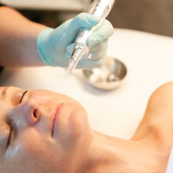 Heidi Kao, DAOM, LAC - Microneedlinig