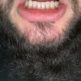 Reza Dental Care - After! - General Dentistry Near Me - South Gate, California