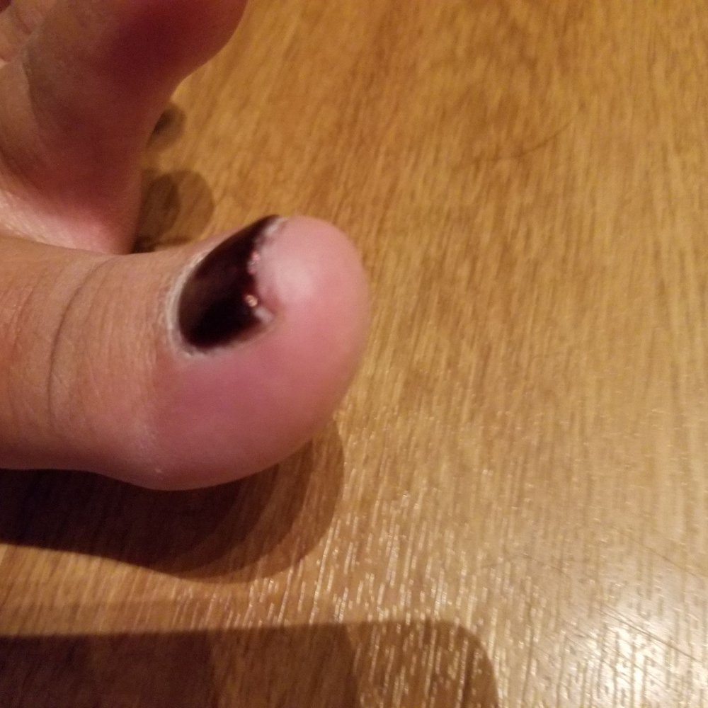 VIP Nail Salon - Jagged uneven polish on my pedicure. - Nail Salons Near Me - Hanover, Maryland VIP Nail Salon - Jagged uneven polish on my pedicure. - Nail Salons Near Me - Hanover, Maryland