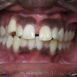 Alex Wakter, DDS - World Exchange Dental