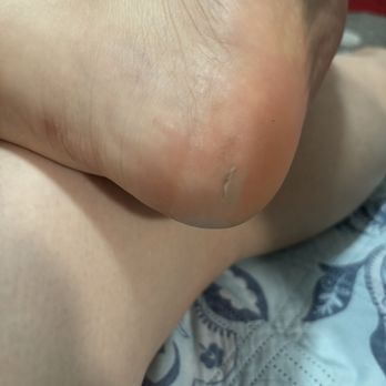 Royal Beauty Studio - They cut my bottom of my foot !!! - Nail Salons Near Me - New York, New York Royal Beauty Studio - They cut my bottom of my foot !!! - Nail Salons Near Me - New York, New York