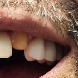 Perry Fraiman, DDS