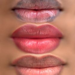 V-BEAUTY  - Dark lips naturalization