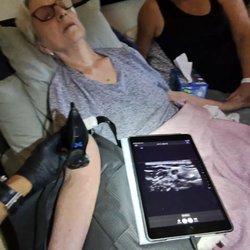 Eternity IV - With Ultrasound -First attempt success, reduce "fishing", visualize hidden anatomy, & less pain and anxiety!