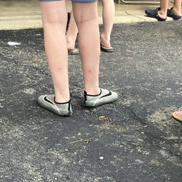 Son's legs covered in flea bites