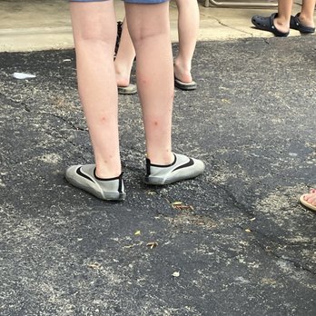 Apple Tree Inn - Son's legs covered in flea bites - Hotels Near Me - Spokane, Washington