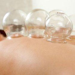 Balance Acupuncture of LI