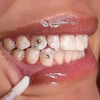Alexah Iced You - Cosmetic Dentists Near Me Alexah Iced You - Cosmetic Dentists Near Me
