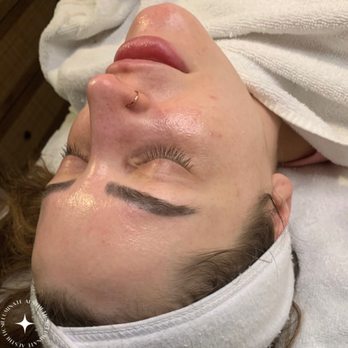 Illuminate Aesthetics - It's never too early or too late to start taking care of your skin!
Start prioritizing your body's largest organ, your SKIN - Skin Care Near Me - Surrey, British Columbia Illuminate Aesthetics - It's never too early or too late to start taking care of your skin!
Start prioritizing your body's largest organ, your SKIN - Skin Care Near Me - Surrey, British Columbia