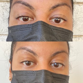 Bijou Beauty - Lash Lift & Regan by: Lira - Skin Care Near Me - West Hollywood, California