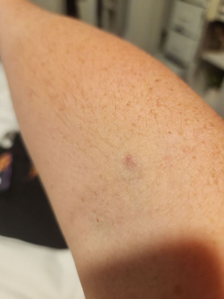 Cheryl Ann Brewer, MD - patient advocate in Las Vegas, NV