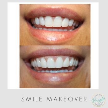 Bright Inspired Dentistry - Cosmetic Dentists Near Me - Concord, North Carolina