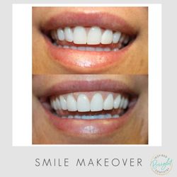 Bright Inspired Dentistry