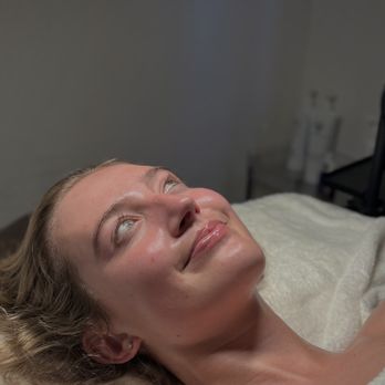 Ella Marie Esthetics - Signature Custom Facial Results - Estheticians Near Me - Encinitas, California