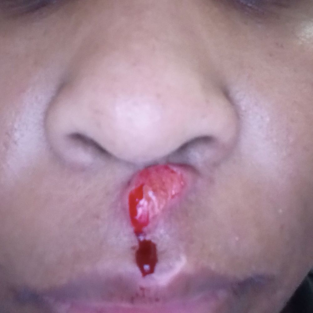 CSL Plasma - Do not donate. Fainted and got $12,000 of facial and teeth damage. - Blood & Plasma Donation Centers Near Me - Clifton, New Jersey CSL Plasma - Do not donate. Fainted and got $12,000 of facial and teeth damage. - Blood & Plasma Donation Centers Near Me - Clifton, New Jersey