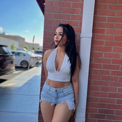 CARA Plastic Surgery & Laser Center - One year post-op