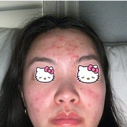 Beauty Legend - 3/26/25