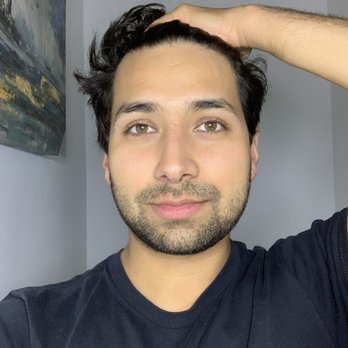 Skin By Lily - After my second session, all my bumps were gone, and nose scar drastically reduced - Skin Care Near Me Skin By Lily - After my second session, all my bumps were gone, and nose scar drastically reduced - Skin Care Near Me