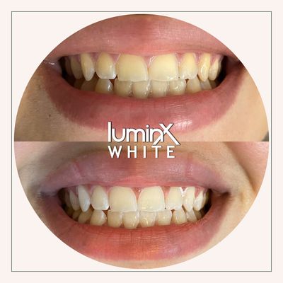 Before & Afters - Before & After from clients Before & Afters - Before & After from clients