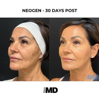 SkinMD - Laser Hair Removal Near Me - Boston, Massachusetts SkinMD - Laser Hair Removal Near Me - Boston, Massachusetts