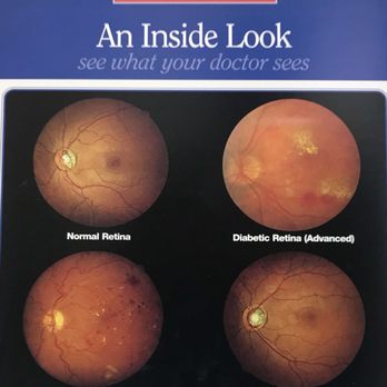 Optometric Vision Care - Some of the conditions which can affect the eye. - Optometrists Near Me - Indian Wells, California Optometric Vision Care - Some of the conditions which can affect the eye. - Optometrists Near Me - Indian Wells, California