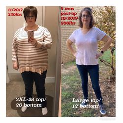 Roller Weight Loss & Advanced Surgery - Weight loss results