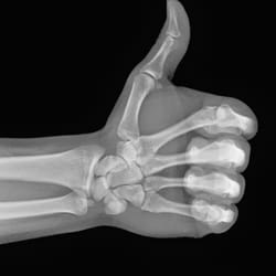 Cobourg X-ray & Ultrasound - Thumbs up!