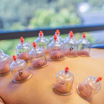 Premium Chiro - Cupping - Chiropractors Near Me - San Diego, California Premium Chiro - Cupping - Chiropractors Near Me - San Diego, California