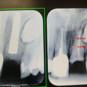 David S. Kim - Laser precision. - General Dentistry Near Me - Newhall, California David S. Kim - Laser precision. - General Dentistry Near Me - Newhall, California