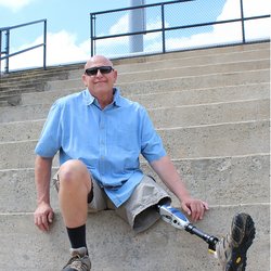 Next Step Prosthetics