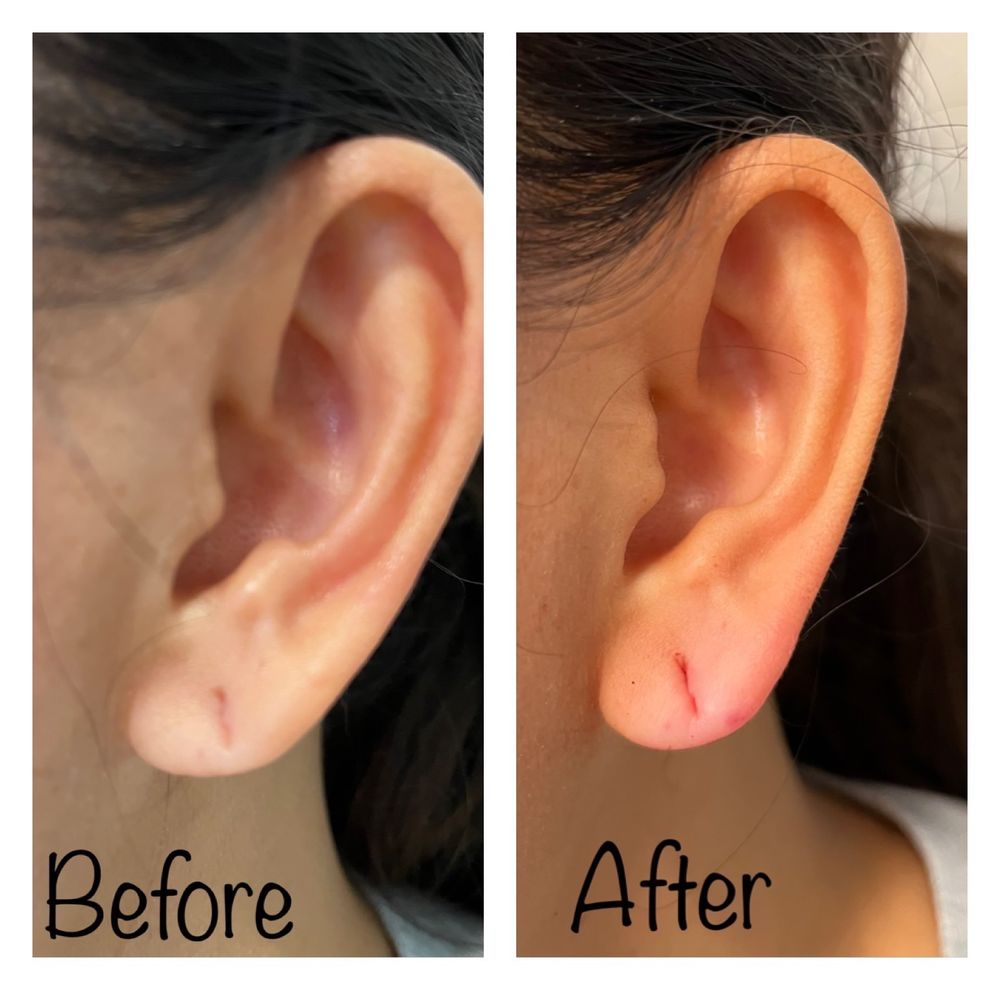 Revitalizing Image Logo