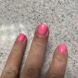 Envie Nail Spa - Middle finger infection.