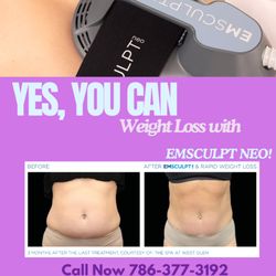 Allied NP Wellness and Primary Care - Ready to sculpt your dream body?
At Allied NP Primary Care in Homestead, we're bringing you the best body contouring technology