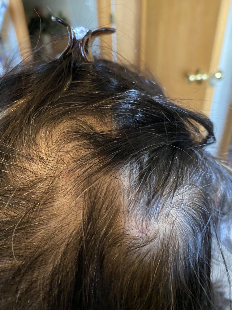 HAIR UNLIMITED OF DENVER INC. Updated September 2024 7535 E Hampden