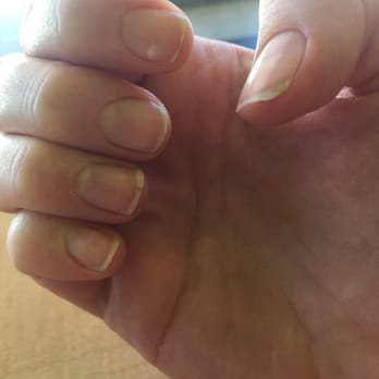 Spa Nails - What my nails look like after leaving in the middle of a horrible mani/pedi. FO NOT GO HERE PEOPLE!!! - Nail Salons Near Me - Hanford, California Spa Nails - What my nails look like after leaving in the middle of a horrible mani/pedi. FO NOT GO HERE PEOPLE!!! - Nail Salons Near Me - Hanford, California